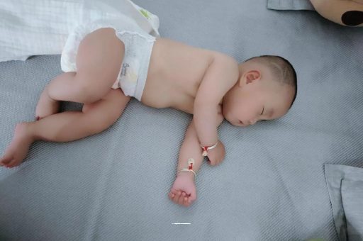 公主岭六个月宝宝眼睛散光